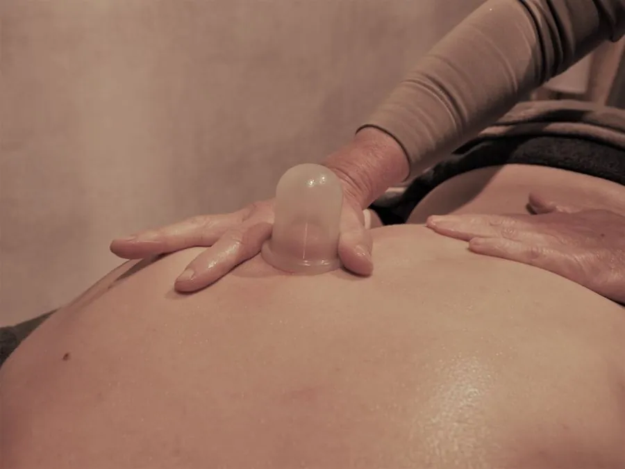 Cupping massage met cup op de rug